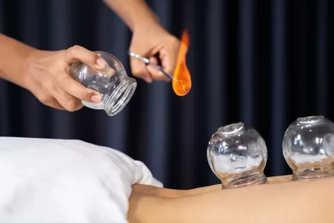 How Chinese Fire Cupping Supports Detoxification and Circulation